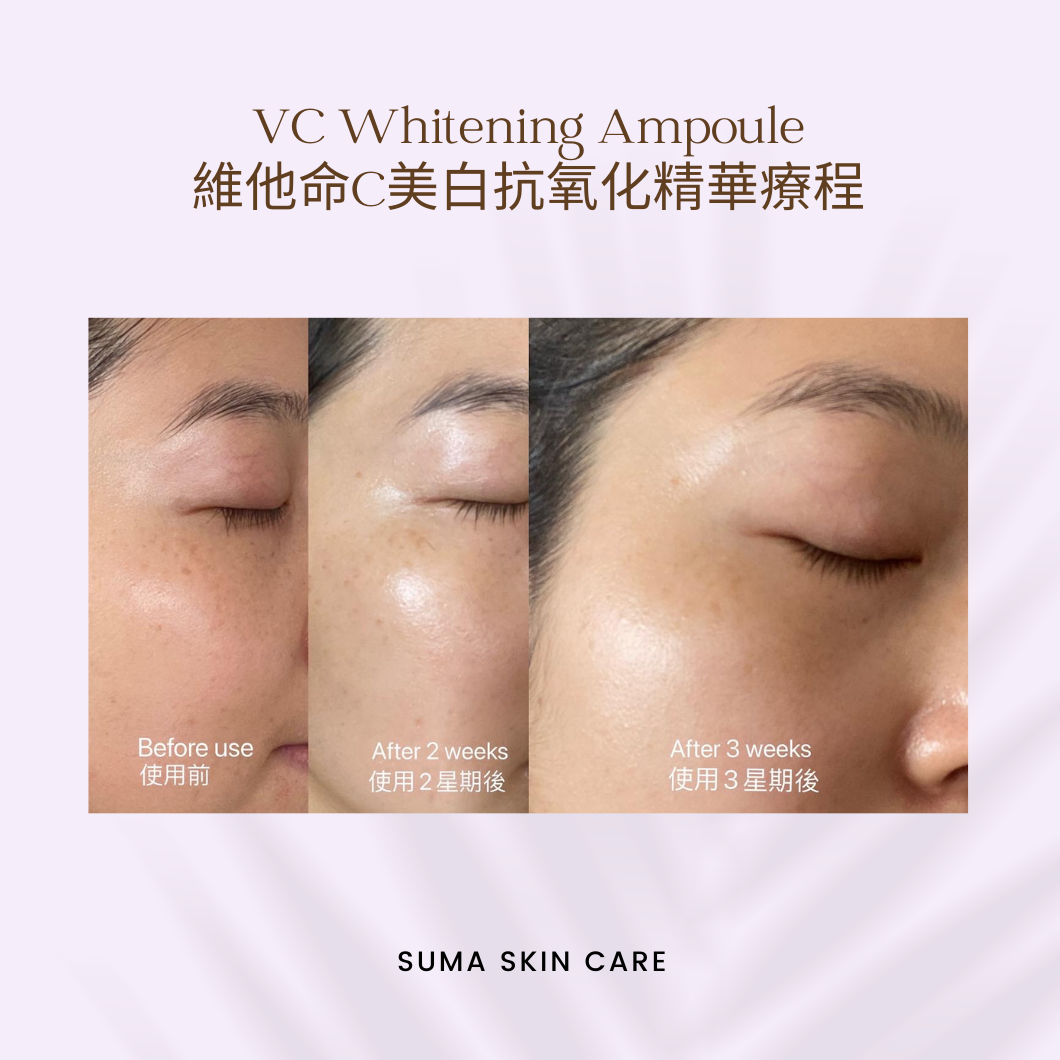 Vitamin C 美白抗氧化精華療程