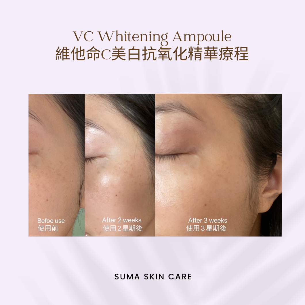 Vitamin C 美白抗氧化精華療程