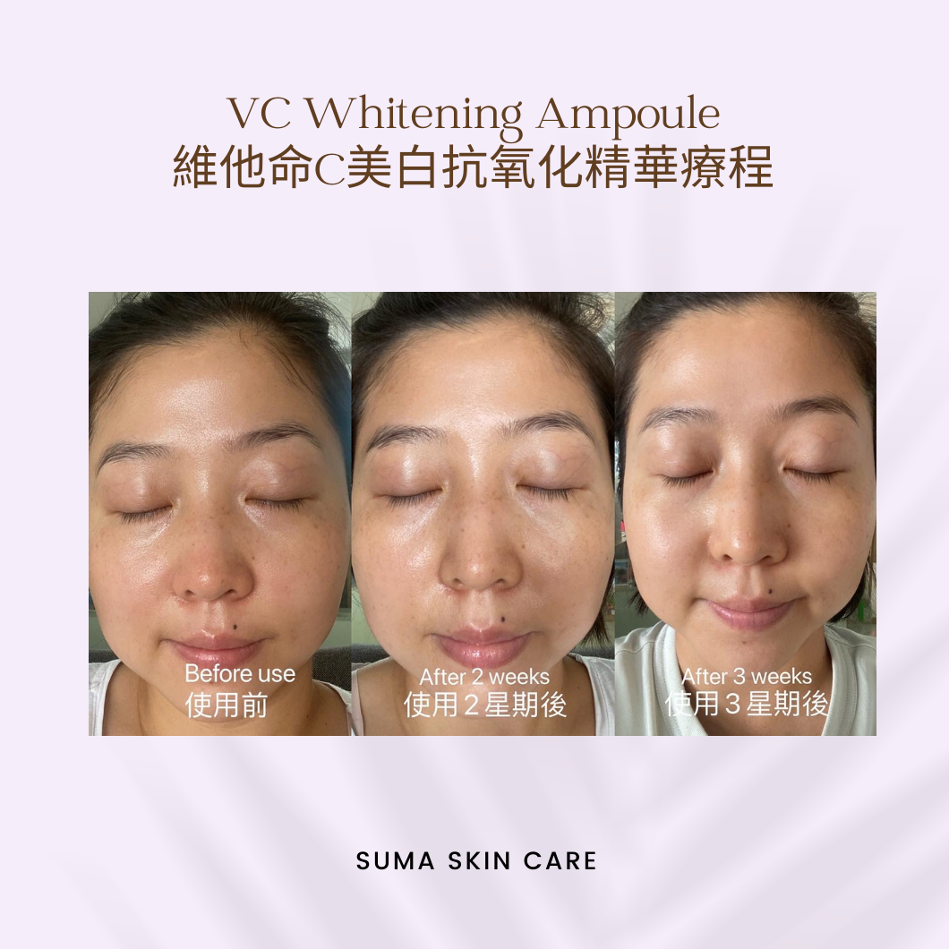 Vitamin C 美白抗氧化精華療程