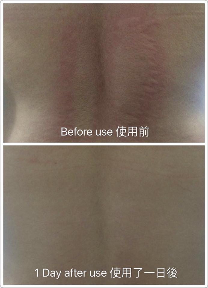 萬用膏 - 成人配方