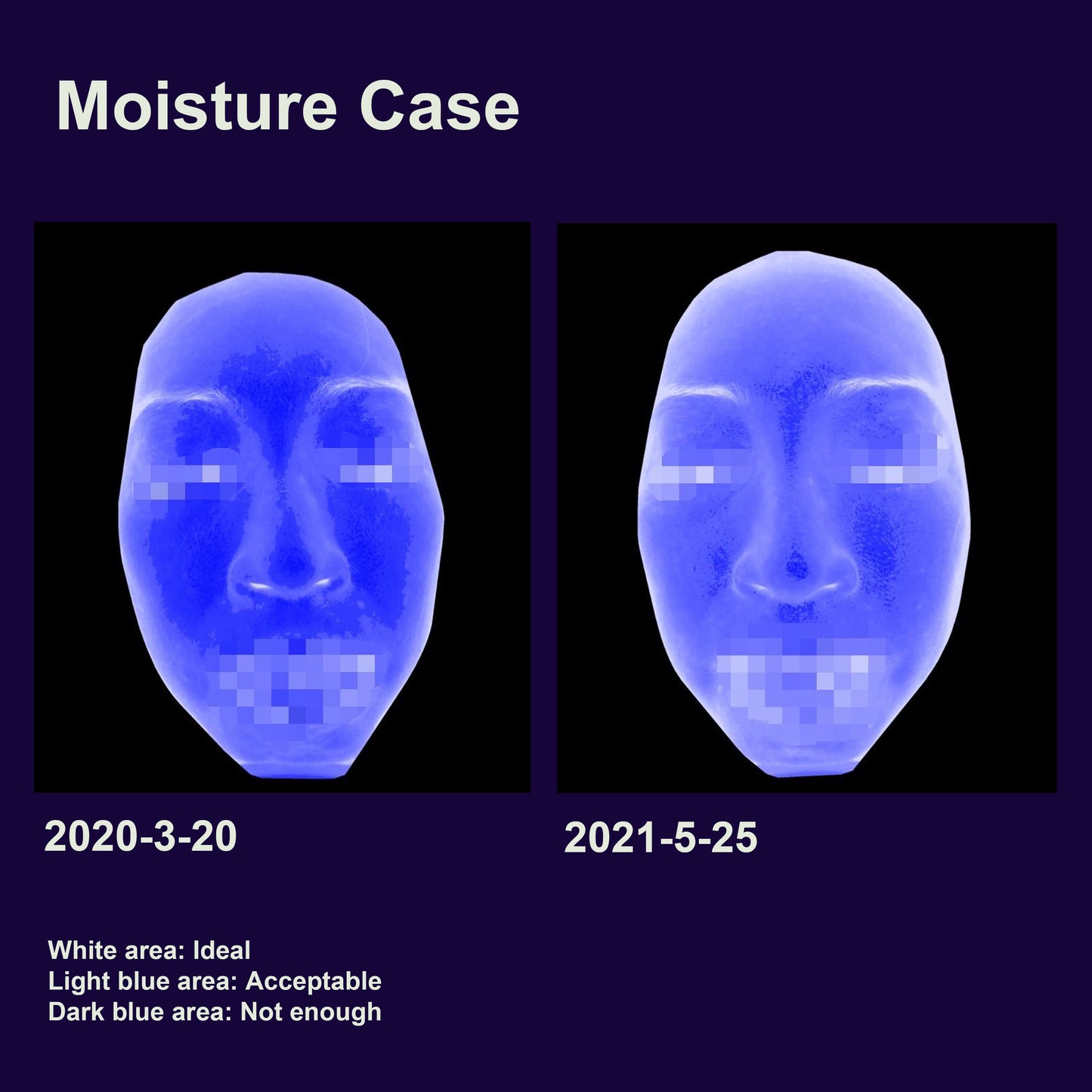 Moisture Raise Intense Hydrator